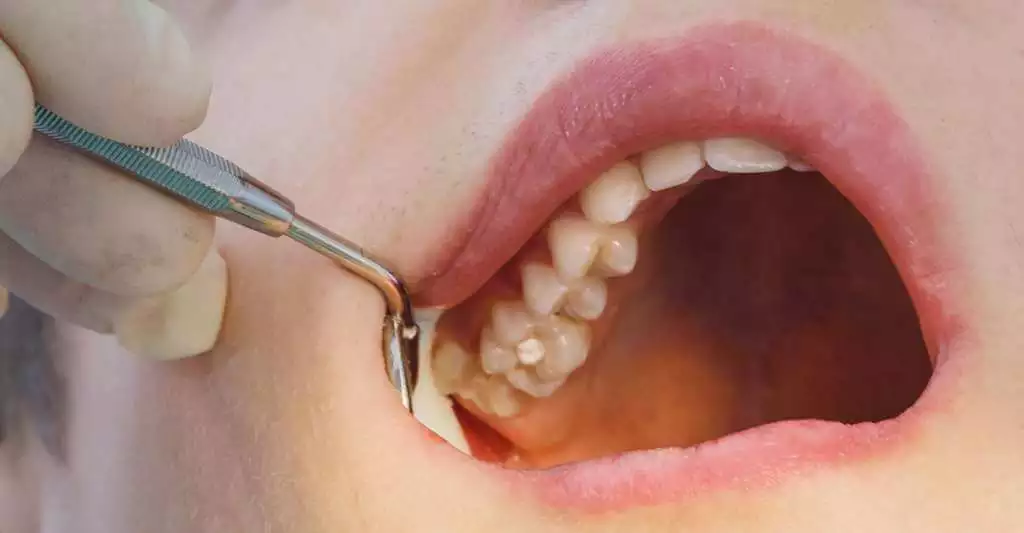 Soins dentaires généraux