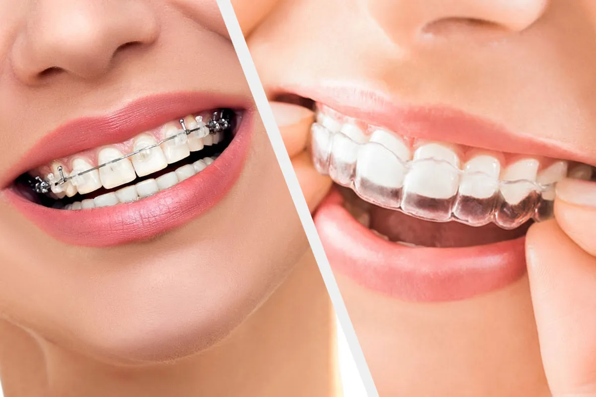 Orthodontie moderne